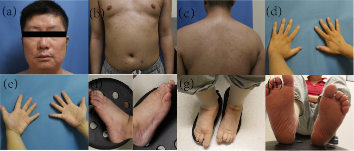Figure 3