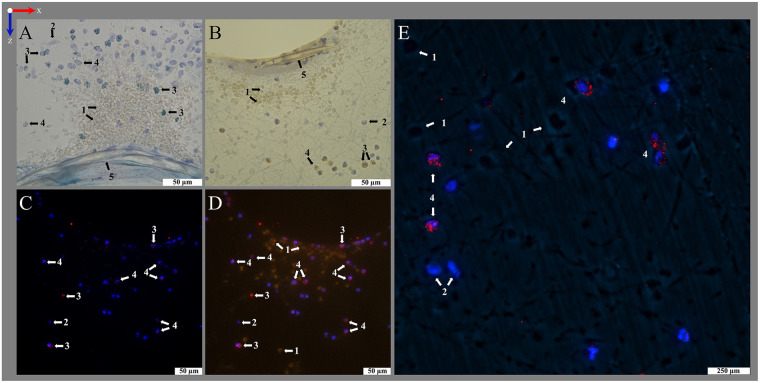 Figure 11