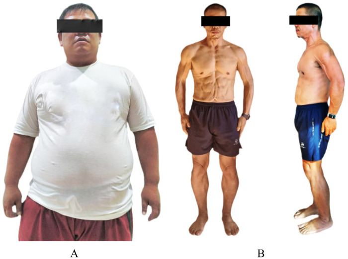 Figure 1