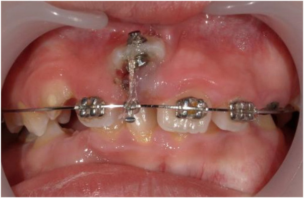 Figure 3