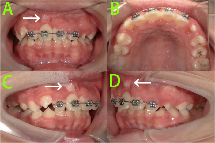 Figure 4