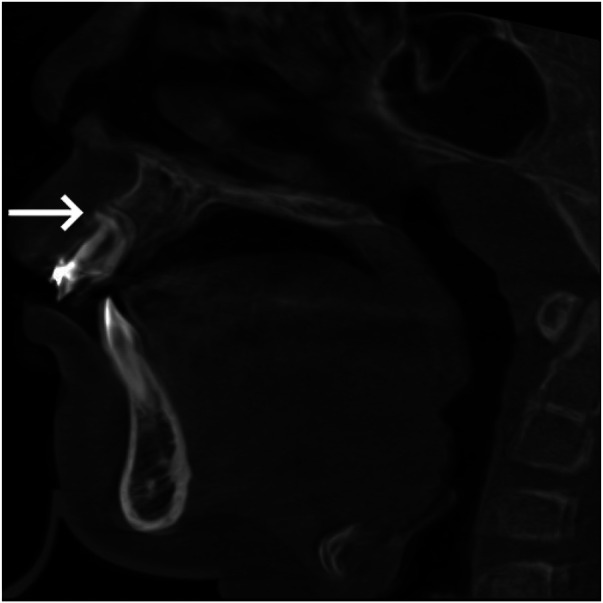 Figure 6