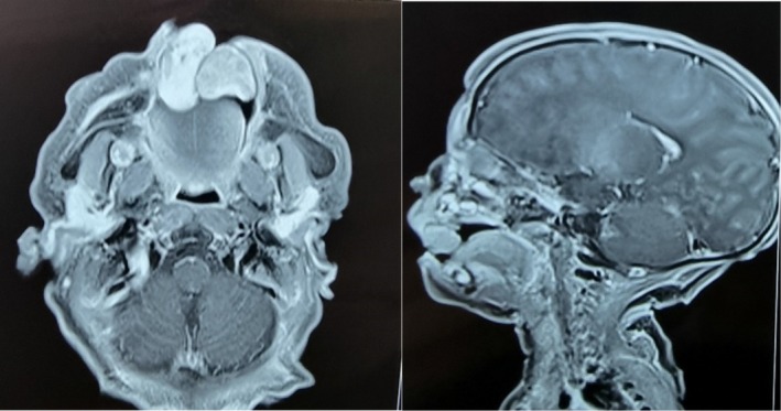 FIGURE 2