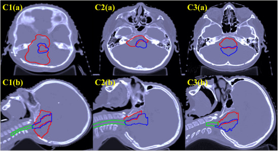 FIGURE 1