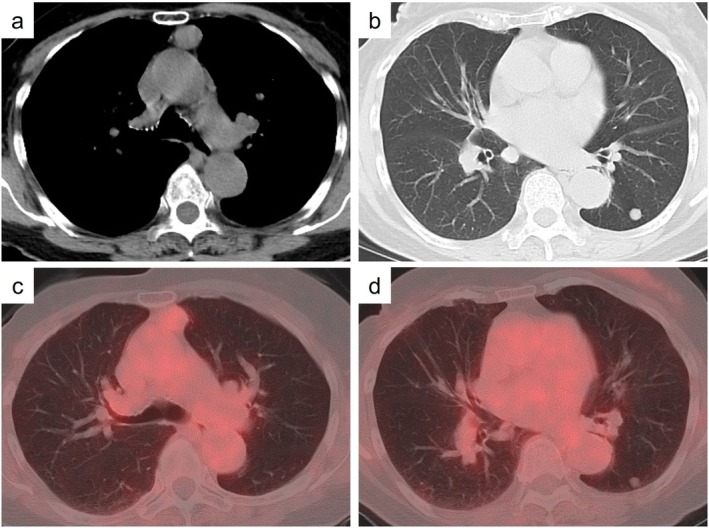 FIGURE 1