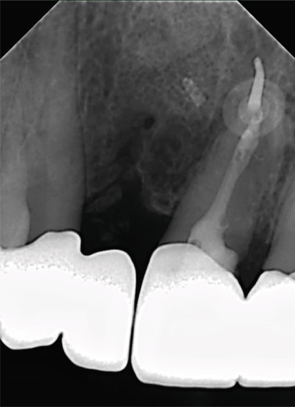 Figure 18