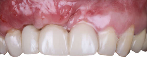 Figure 16