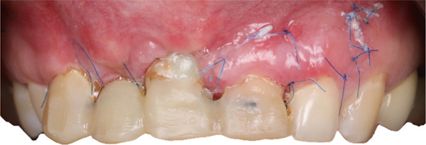 Figure 14