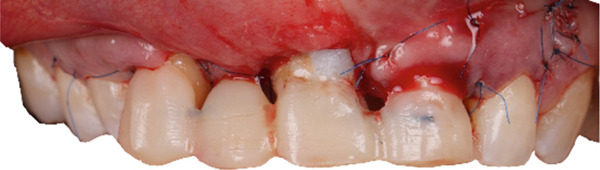 Figure 13