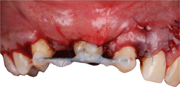 Figure 12