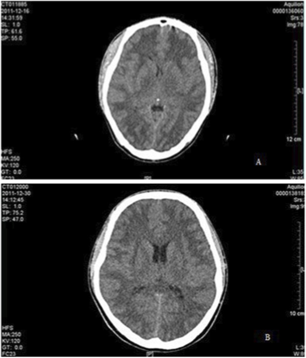 FIGURE 2