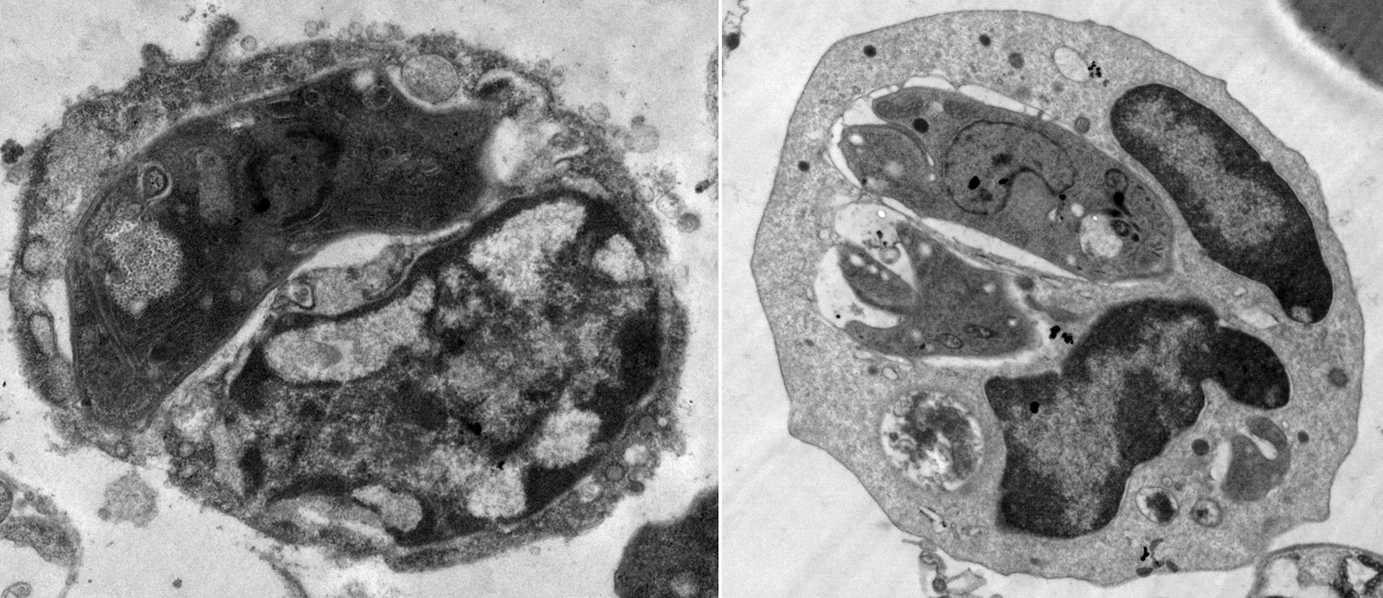 Figure 14