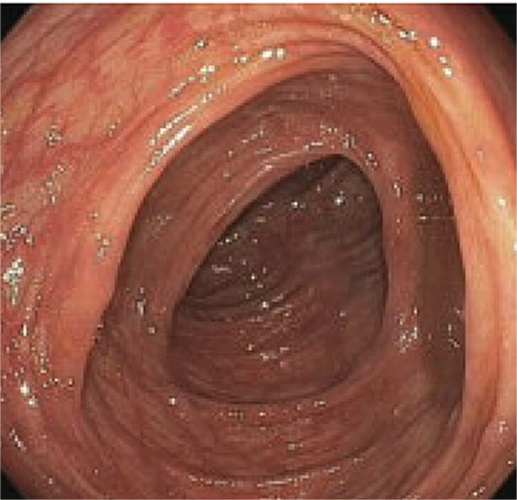 Figure 8