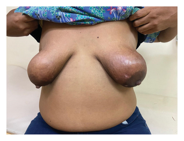 FIGURE 1