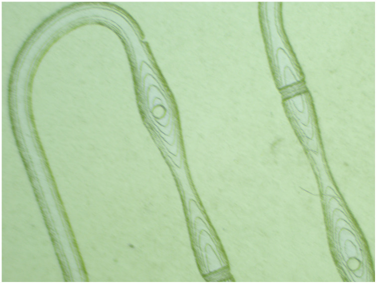 Fig 10