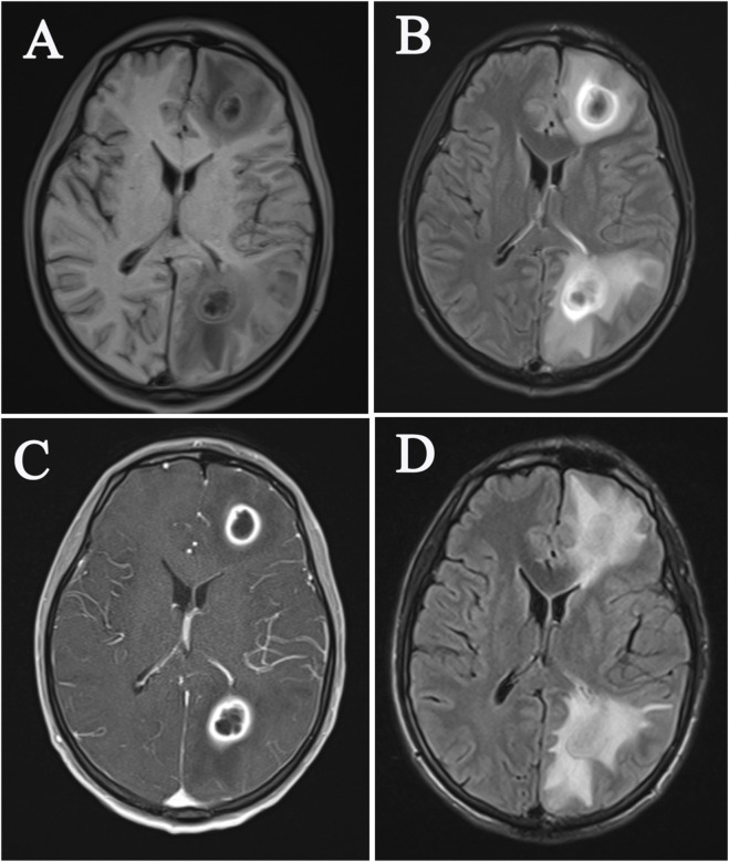 FIGURE 1