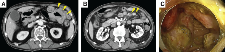 Fig. 2