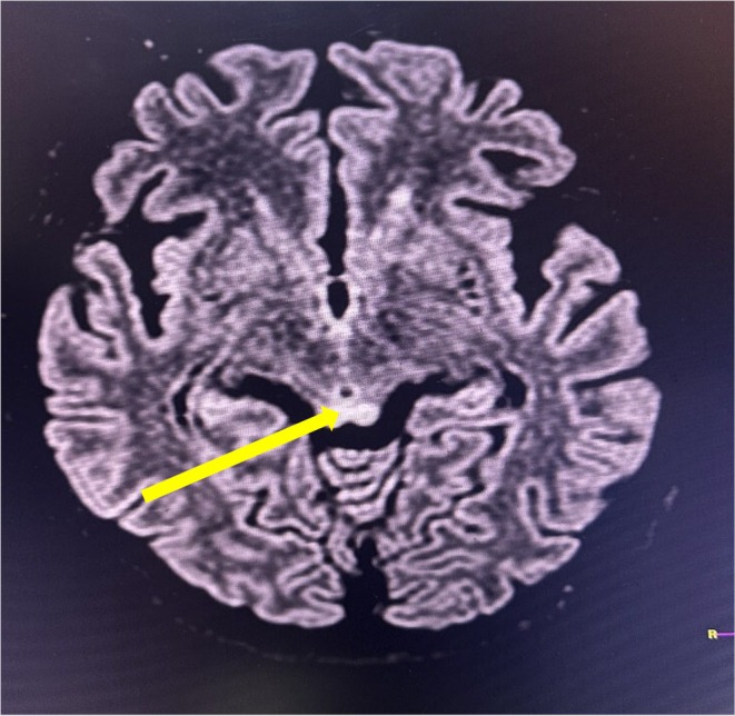 FIGURE 3