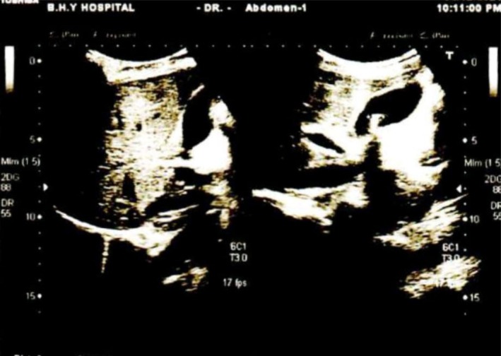 FIGURE 3