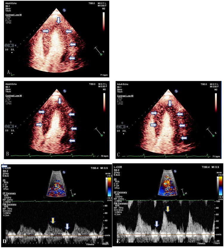 Figure 2