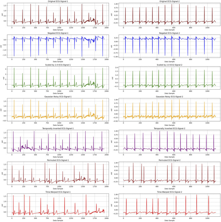 FIGURE 4