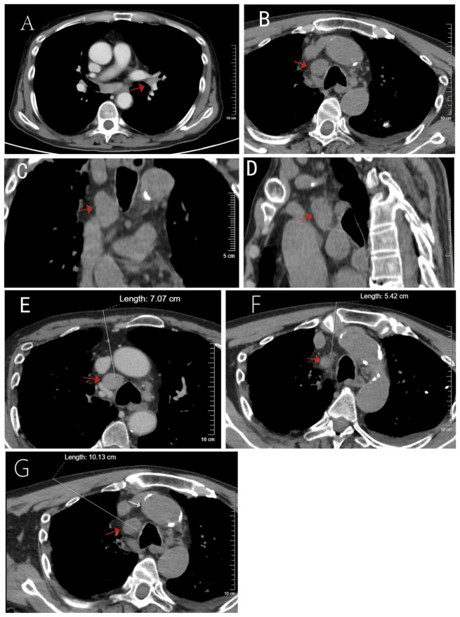Figure 2