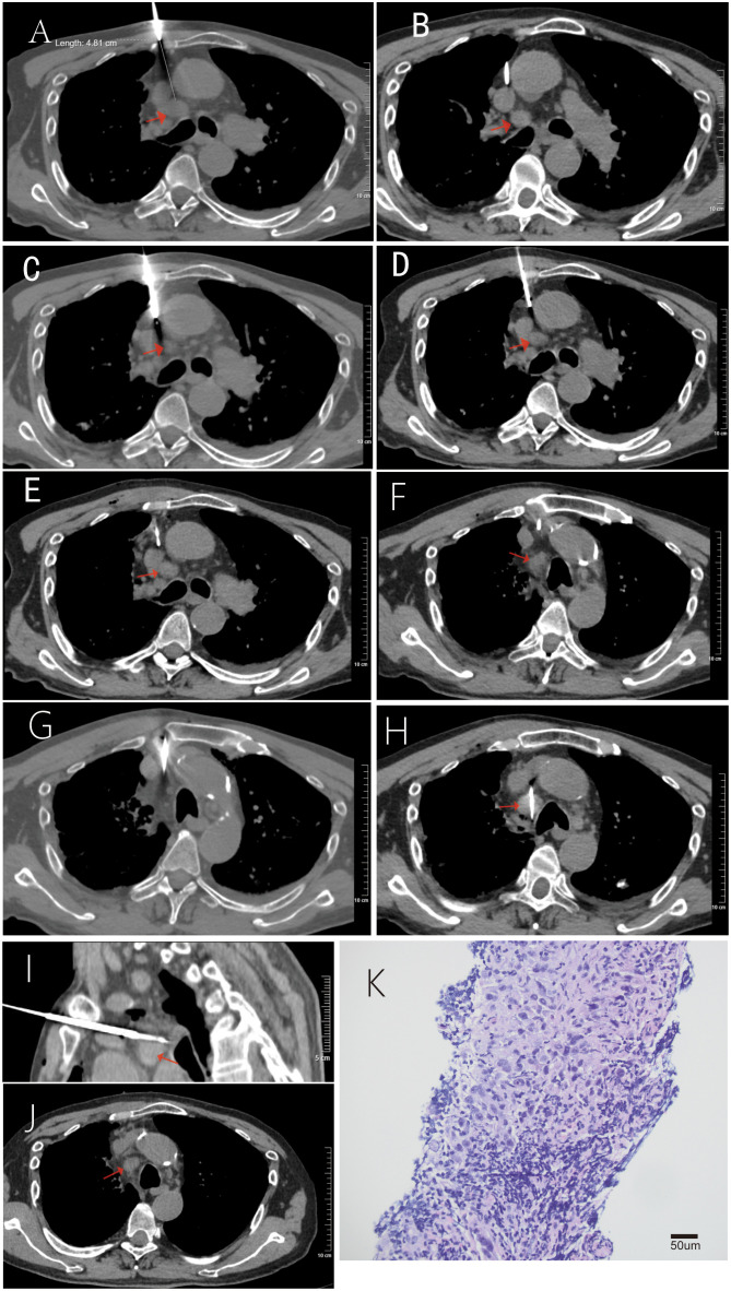 Figure 3