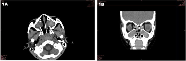 Figure 1