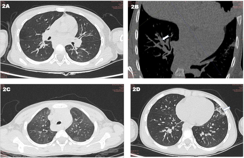 Figure 2