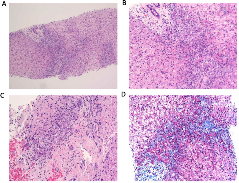 Figure 4
