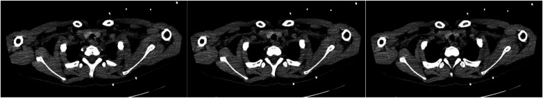 Figure 3