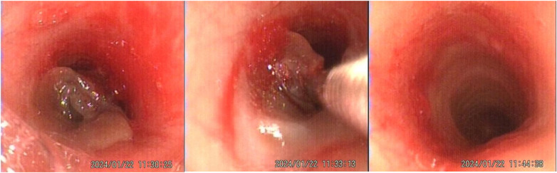 Figure 4
