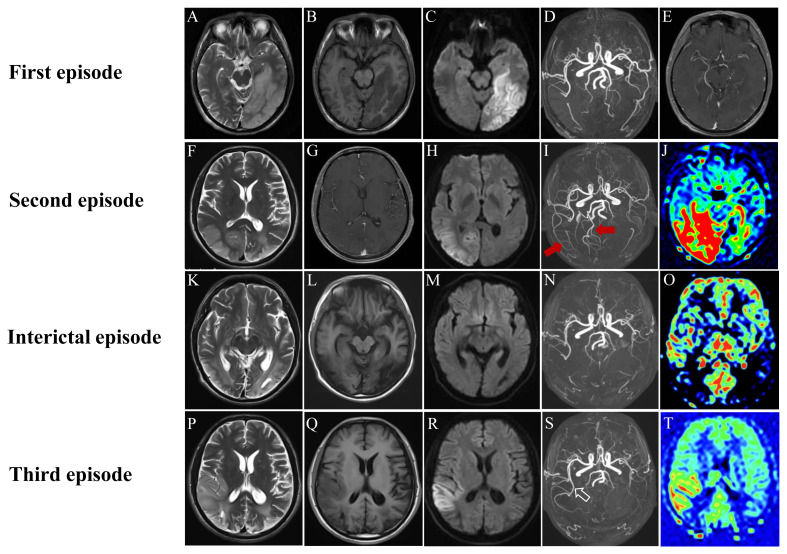 Figure 1