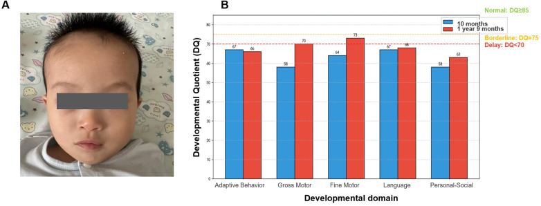 Figure 1
