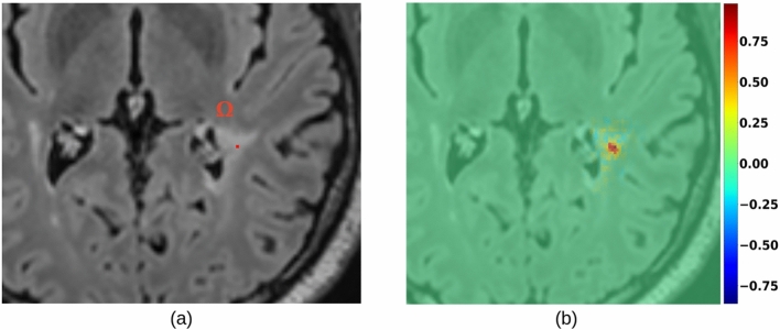Figure 13