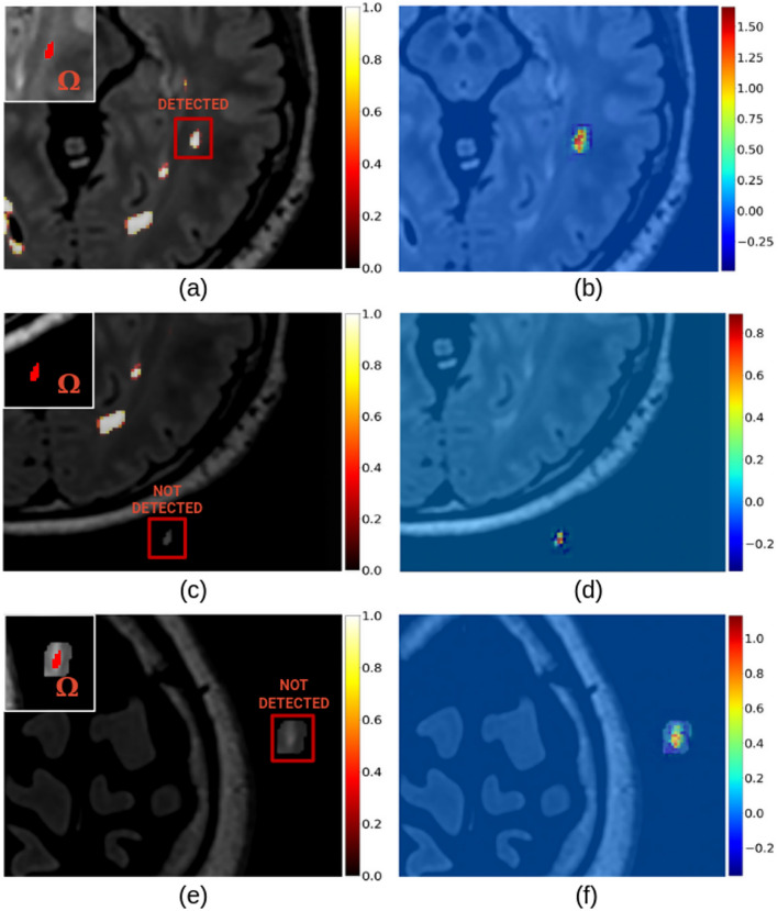 Figure 14
