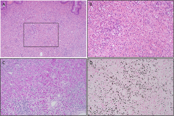 FIGURE 3