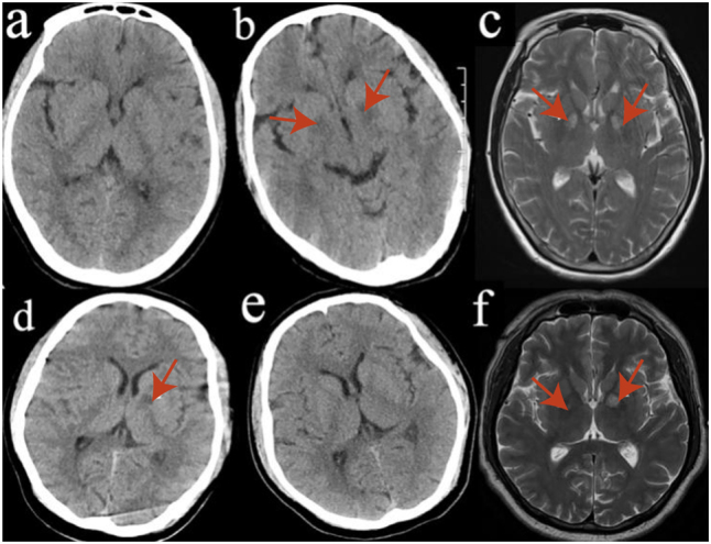 Figure 2