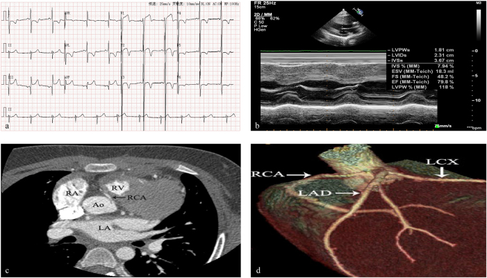 Figure 2