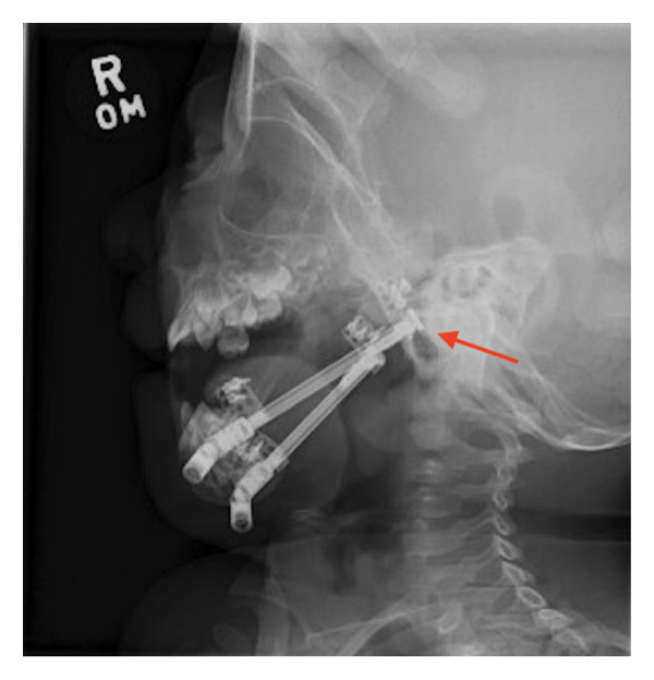 FIGURE 5