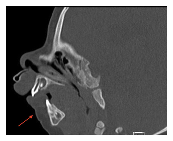 FIGURE 4