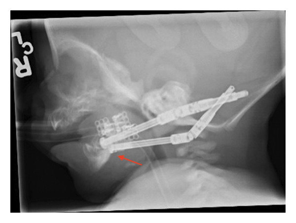 FIGURE 3