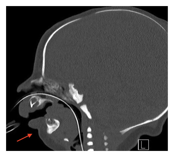 FIGURE 2