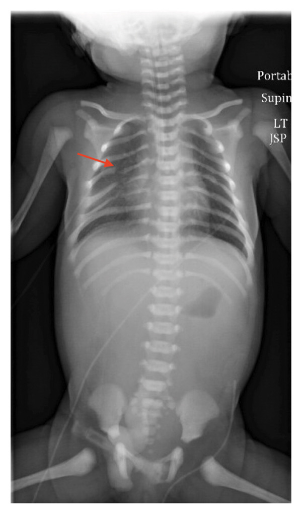 FIGURE 1