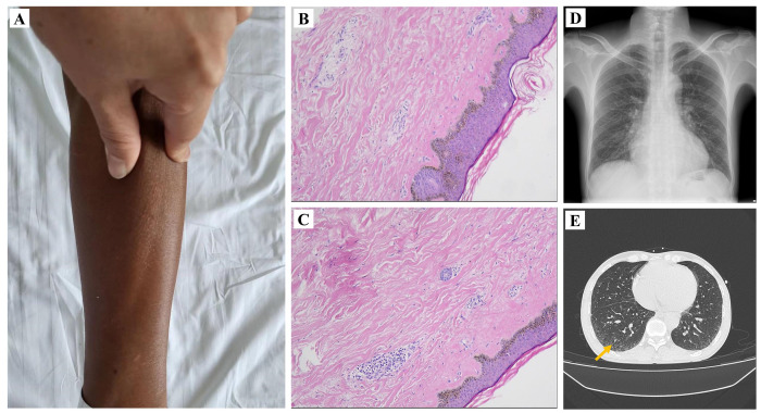 Figure 2