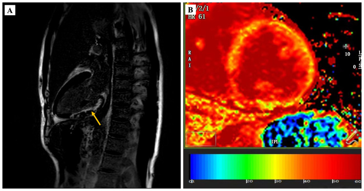 Figure 3