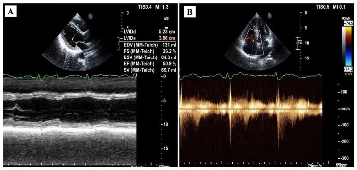 Figure 4