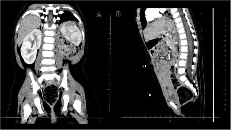 Figure 4