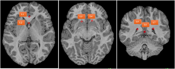 FIGURE 4