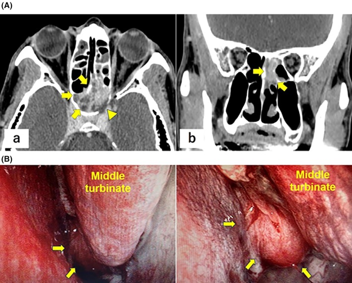 FIGURE 1